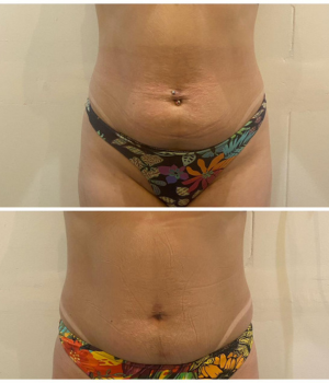 Thais Pires Esteticista | O seu Bem-estar é a nossa prioridade número 1