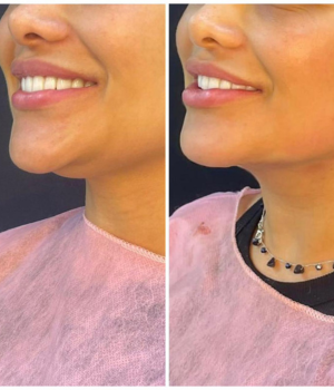 Thais Pires Esteticista | O seu Bem-estar é a nossa prioridade número 1