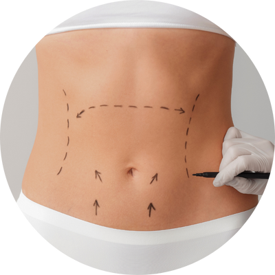 Drenagem Linfática Pós Operatório Thais Pires Esteticista - O seu Bem-estar é a nossa prioridade número 1